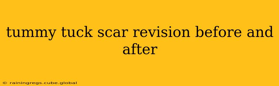 tummy tuck scar revision before and after