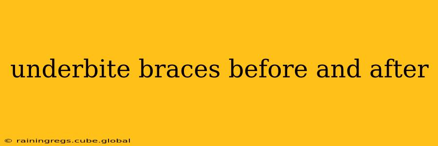 underbite braces before and after
