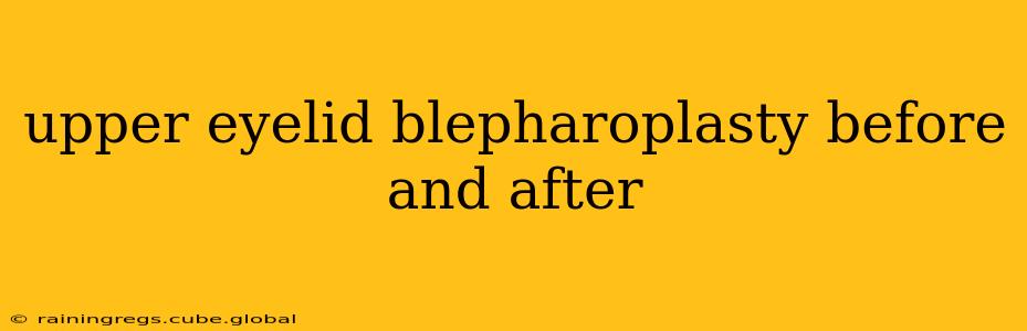 upper eyelid blepharoplasty before and after
