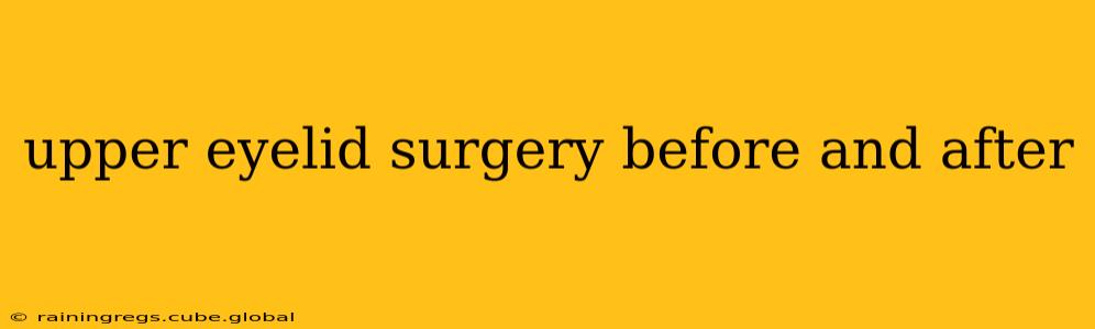 upper eyelid surgery before and after