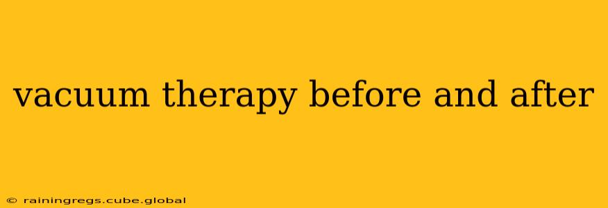 vacuum therapy before and after