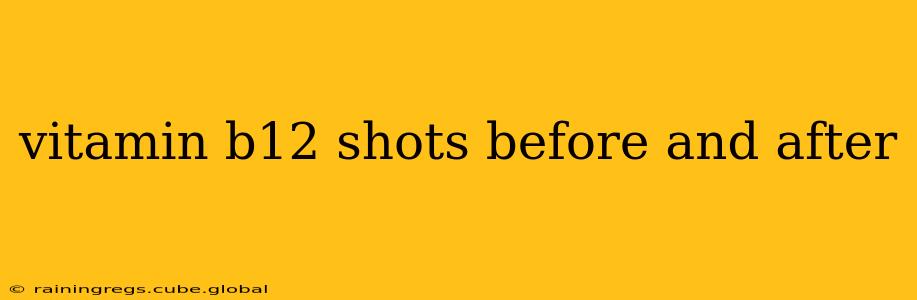 vitamin b12 shots before and after