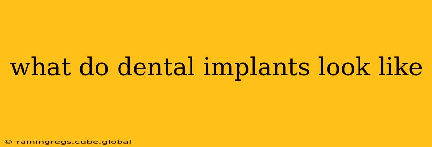 what do dental implants look like