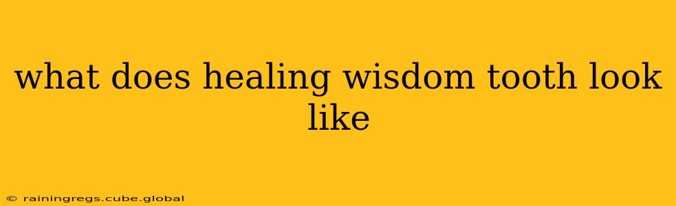 what does healing wisdom tooth look like
