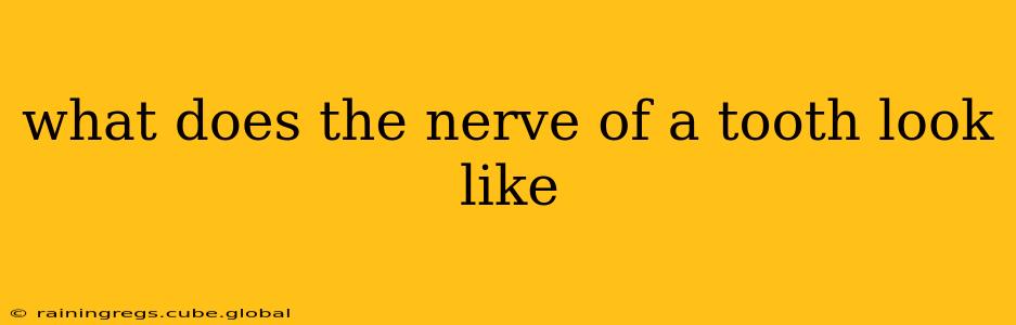 what does the nerve of a tooth look like