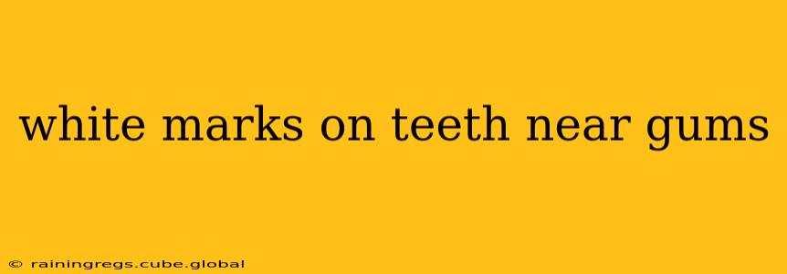 white marks on teeth near gums