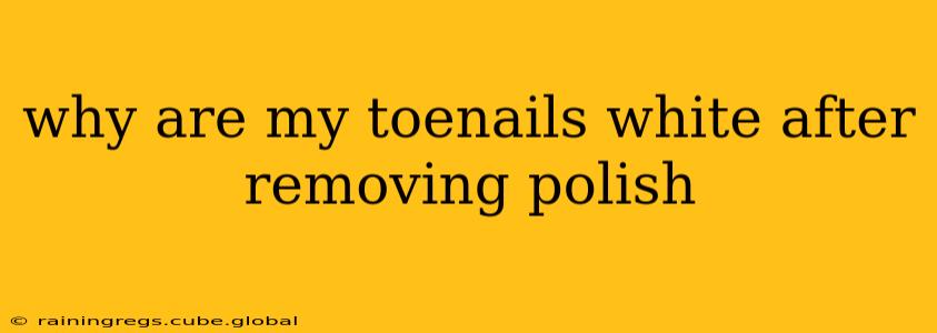 why are my toenails white after removing polish