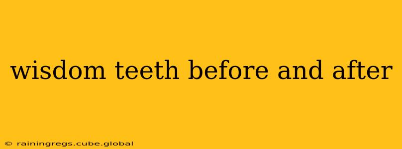 wisdom teeth before and after