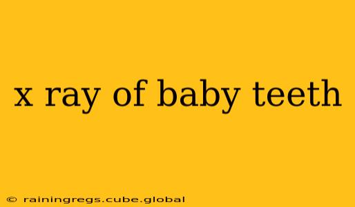 x ray of baby teeth